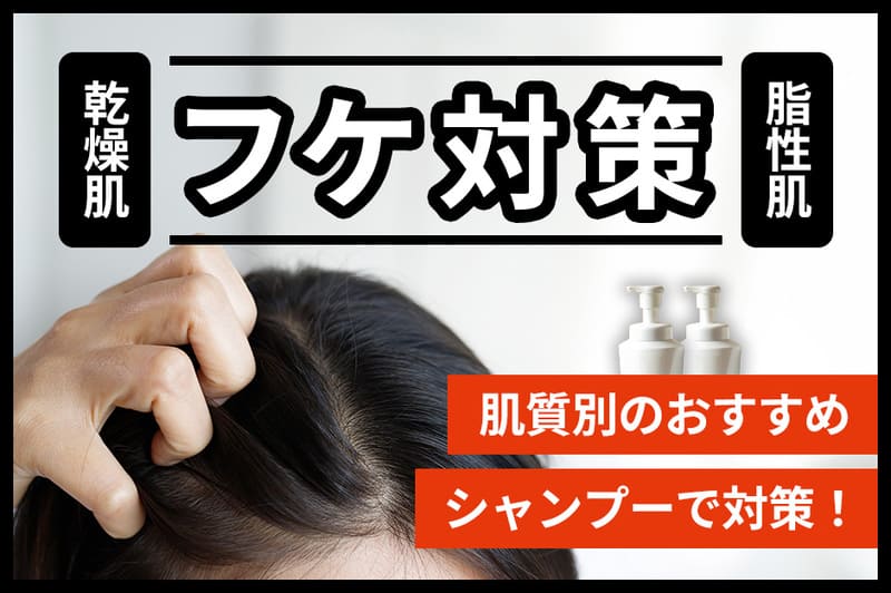 フケ対策シャンプーおすすめ人気20選【2026年9月】乾燥・脂性別の対策アイテムを紹介